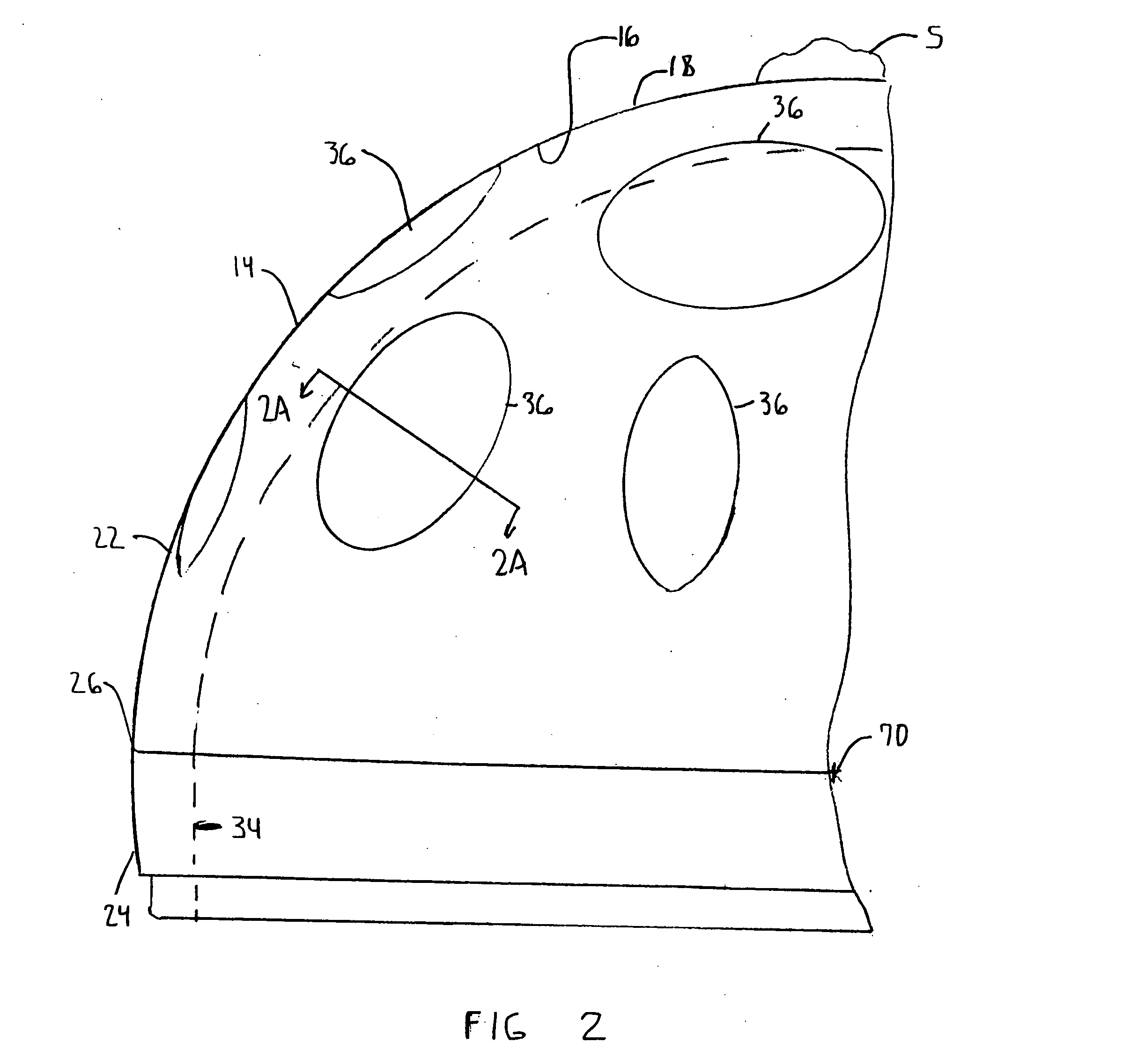 Extended radius prosthesis and associated method