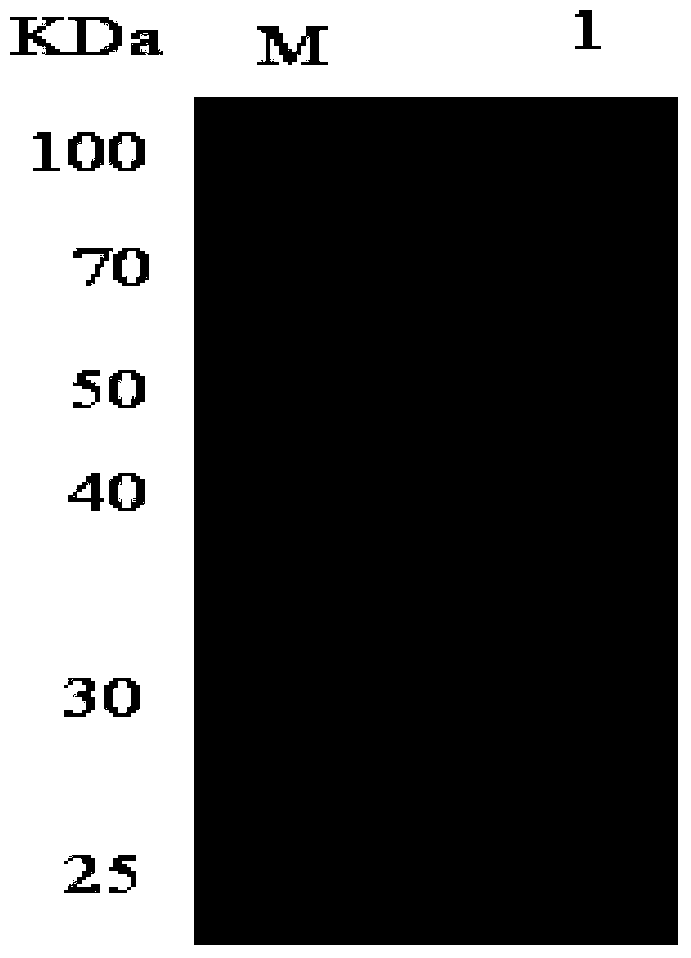 ef-tu protein monoclonal antibody mab of Brucella malta and its preparation method and application