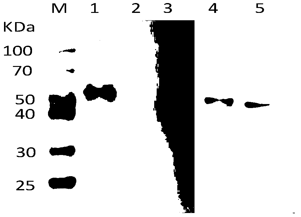 ef-tu protein monoclonal antibody mab of Brucella malta and its preparation method and application