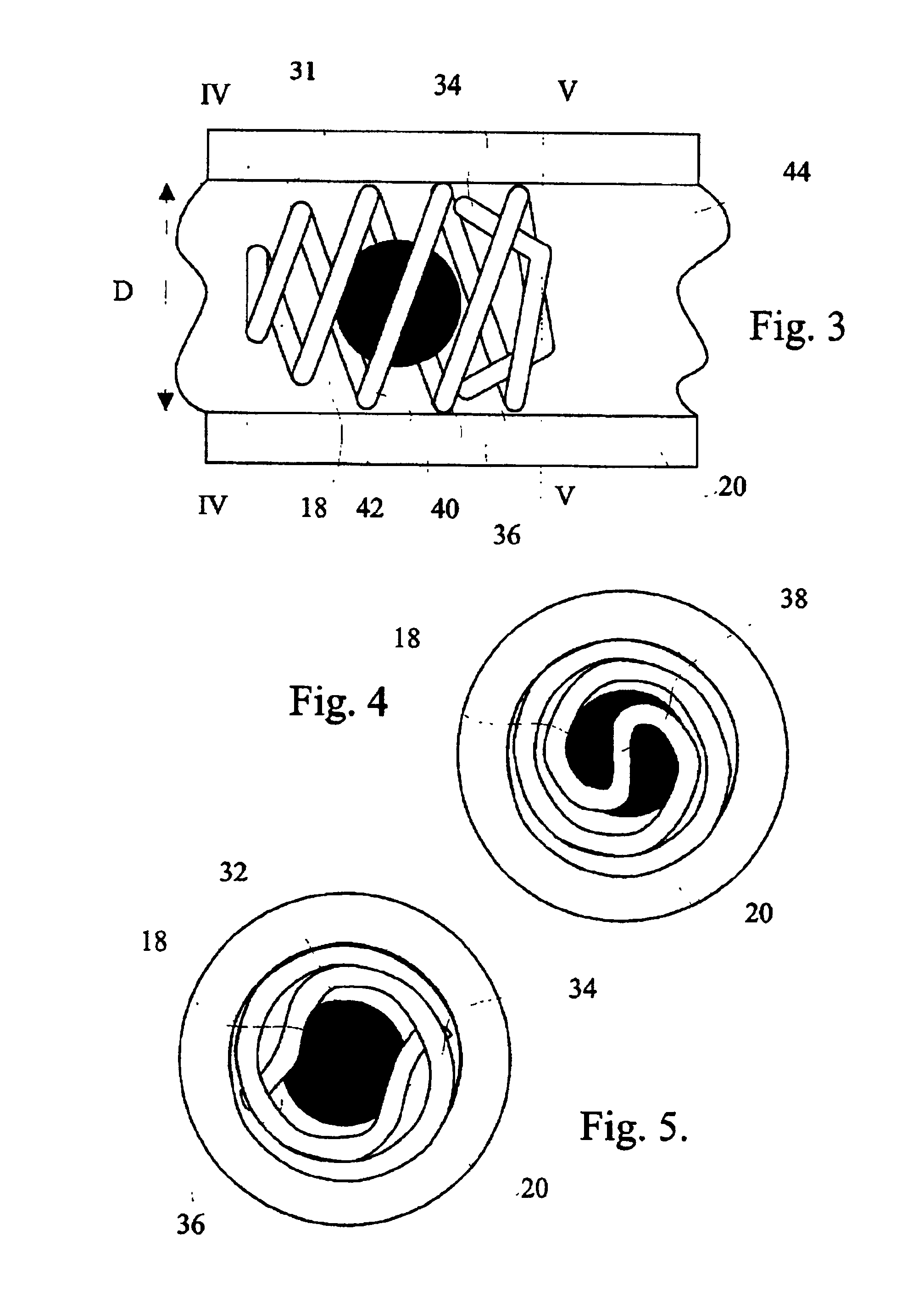 Device and method for retaining mercury source in low-pressure discharge lamps