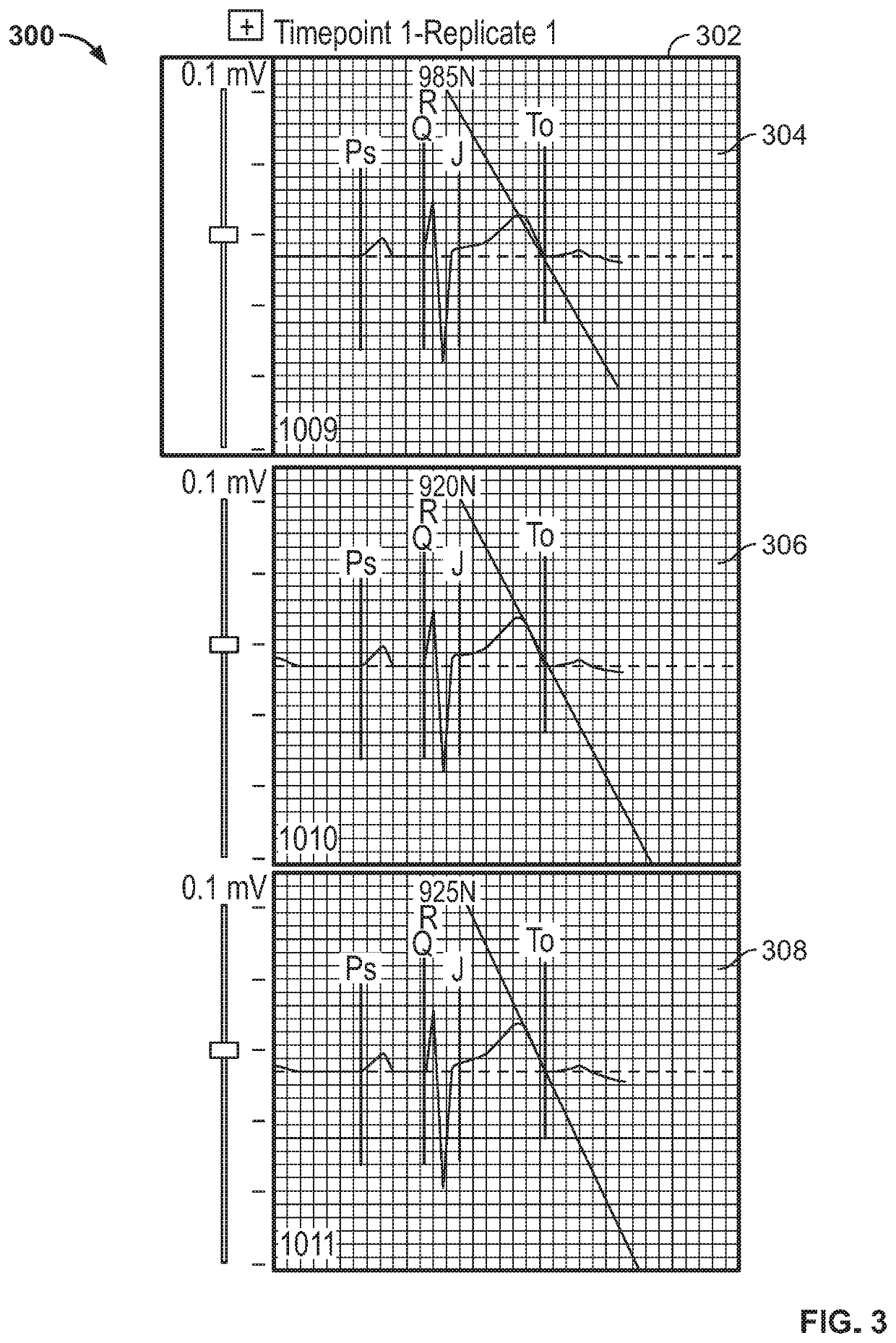 Methods and systems for characterizing the quality of an electrocardiogram signal