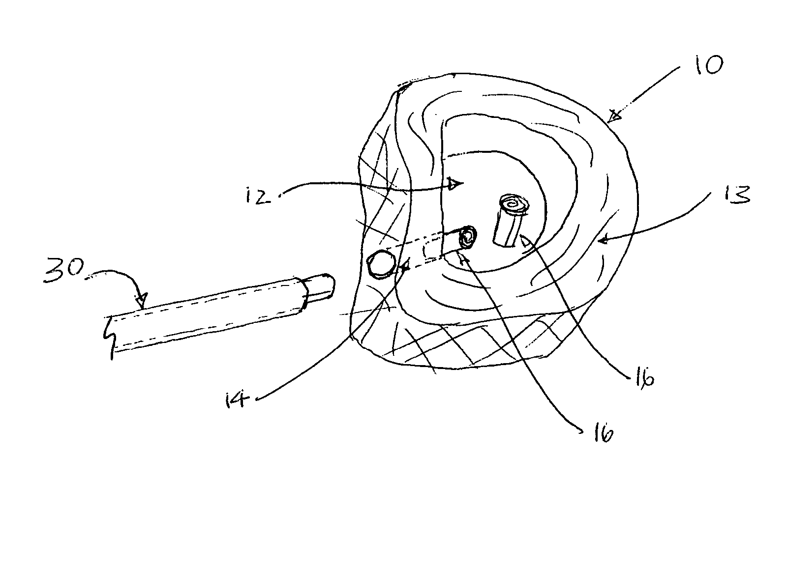 Methods and devices to replace spinal disc nucleus pulposus