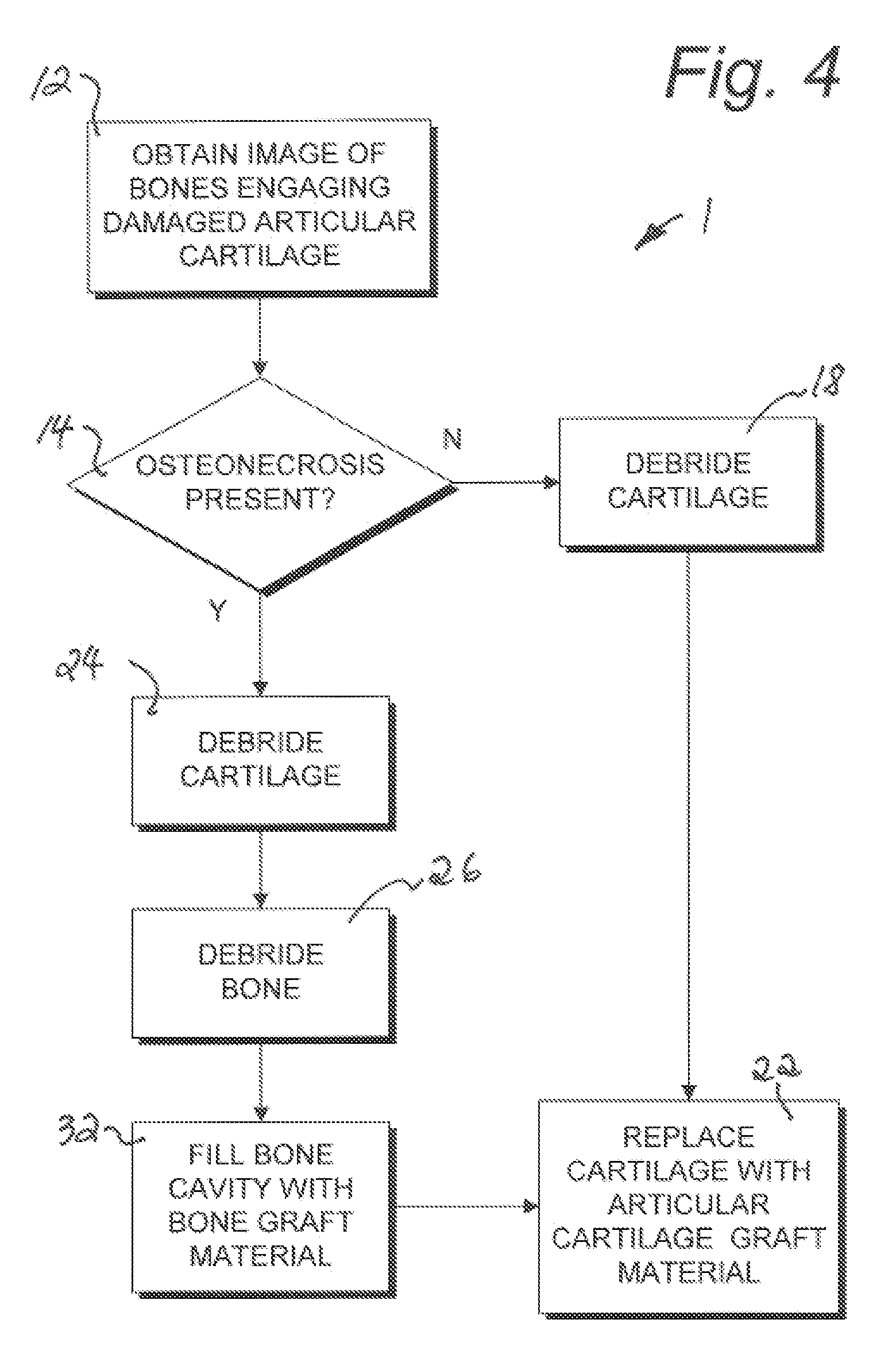 Articular cartilage treatment method