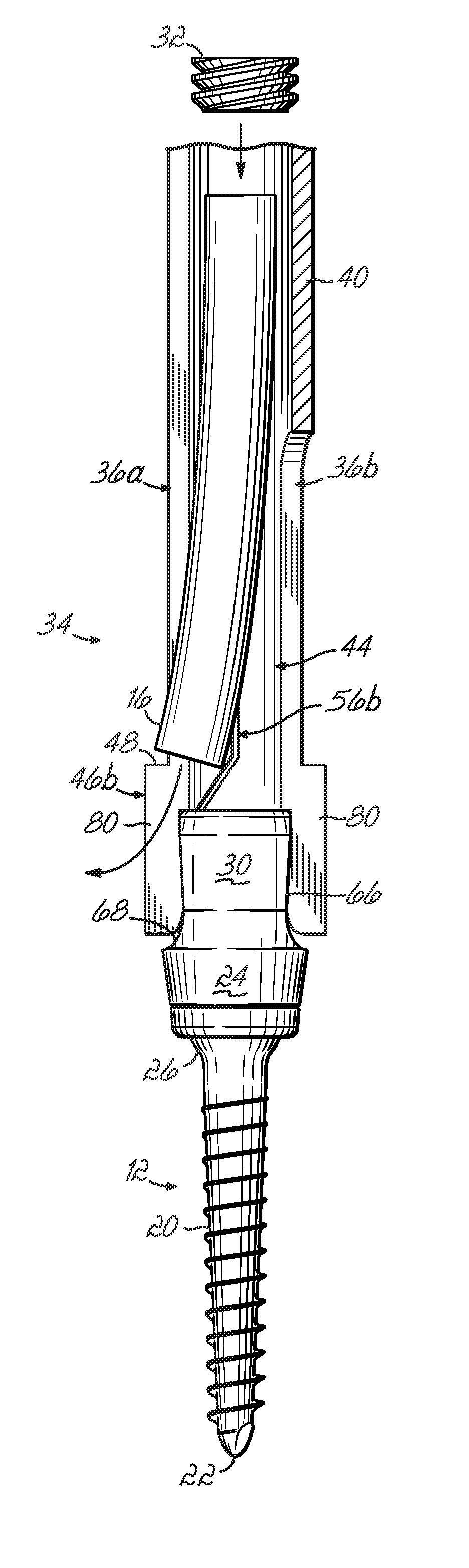 Minimally invasive vertebral anchor access system and associated method