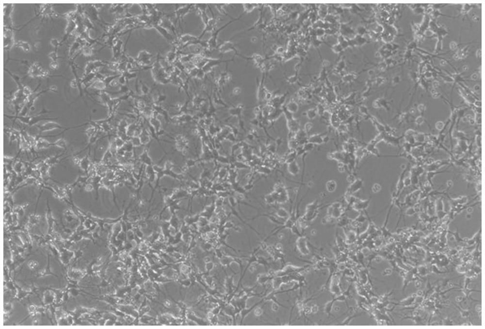 Method and culture medium for in-vitro isolated culture of glioma stem cells