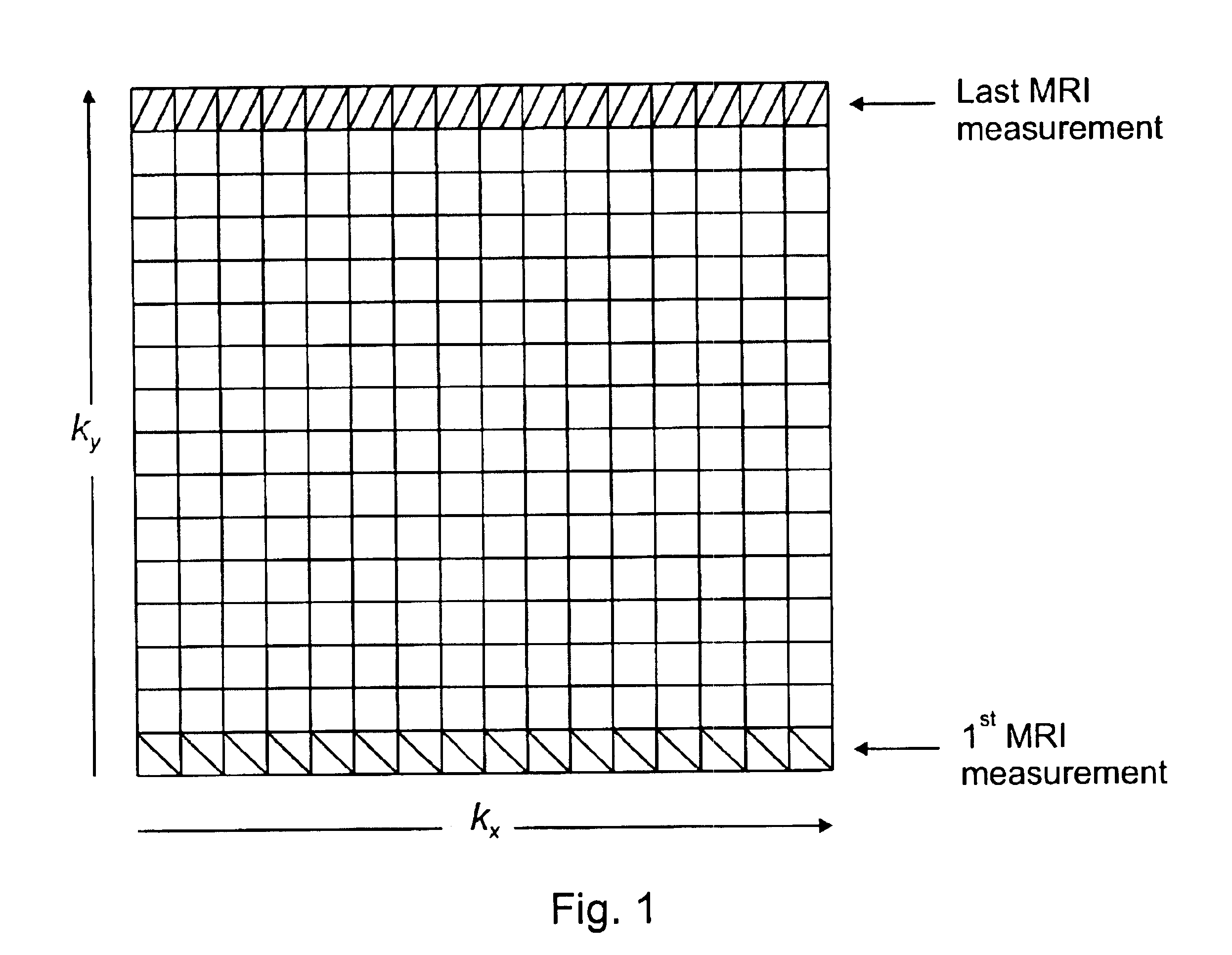 Method and device for correcting organ motion artifacts in MRI systems