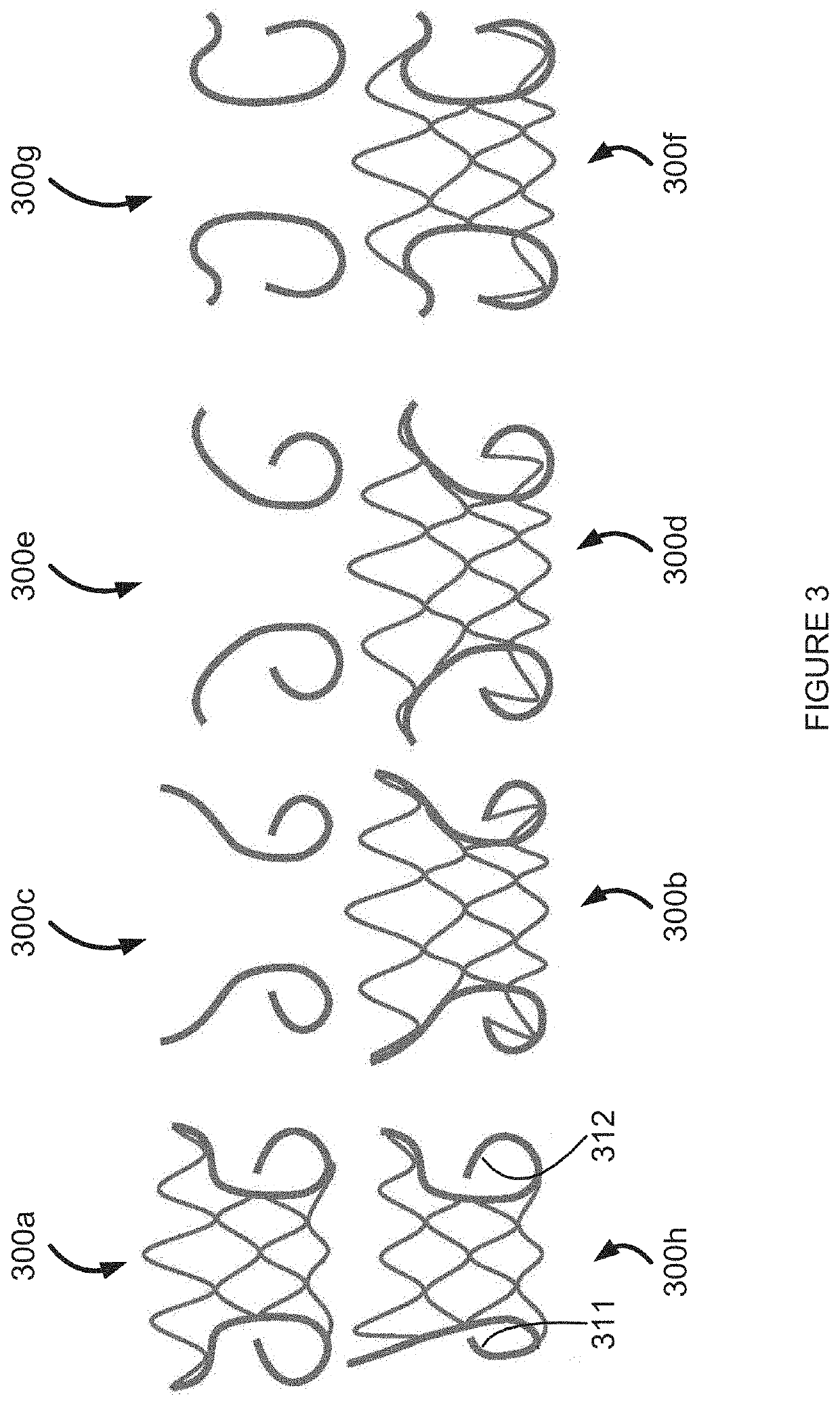 Multi-level cardiac implant