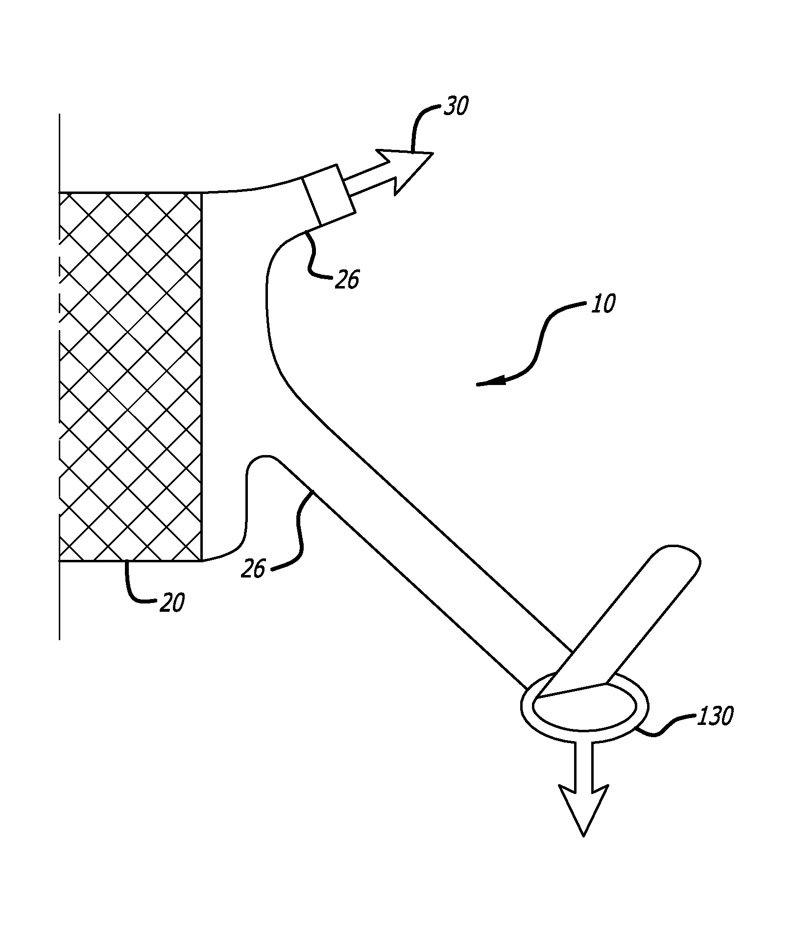 Implants And Procedures For Supporting Anatomical Structures For Treating Conditions Such As Pelvic Organ Prolapse