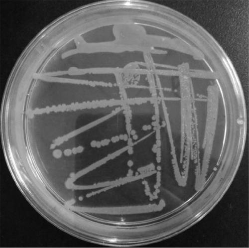 A kind of microbial liquid bacterial fertilizer and its preparation method and application