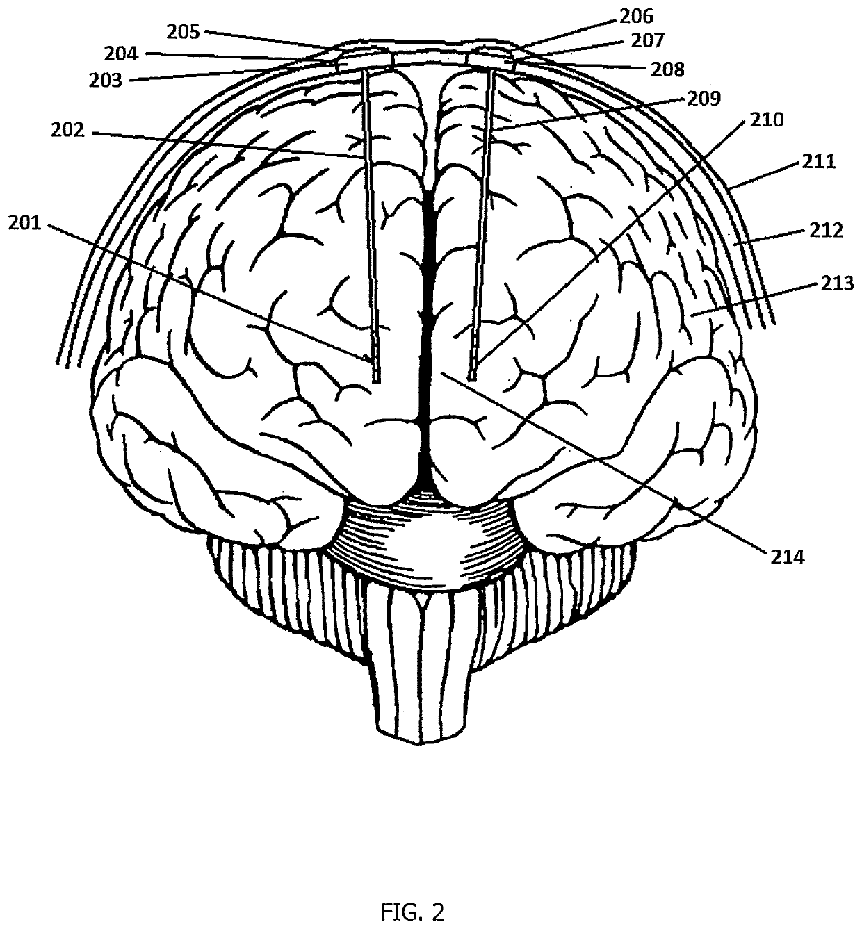 Transcranial current loop stimulation device