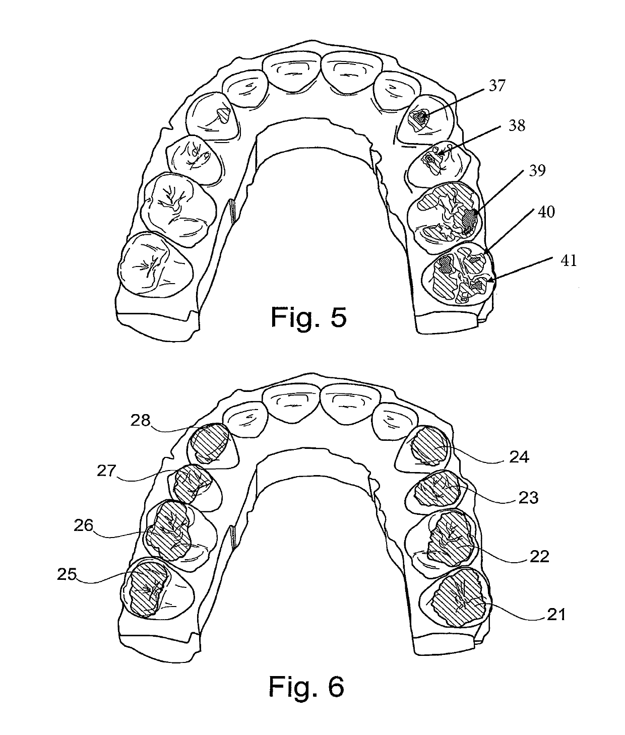 Method for constructing tooth surfaces of a dental prosthesis and for producing dental restorations