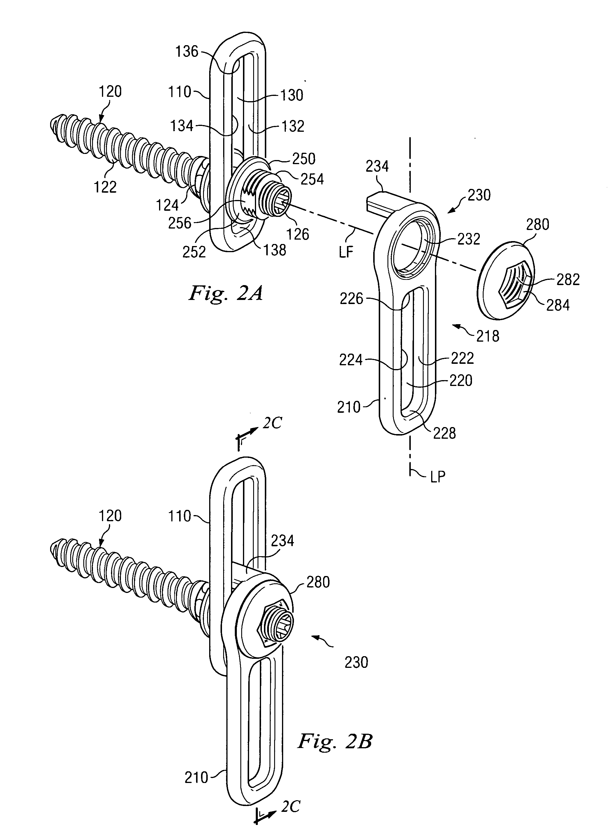 Revision fixation plate and method of use