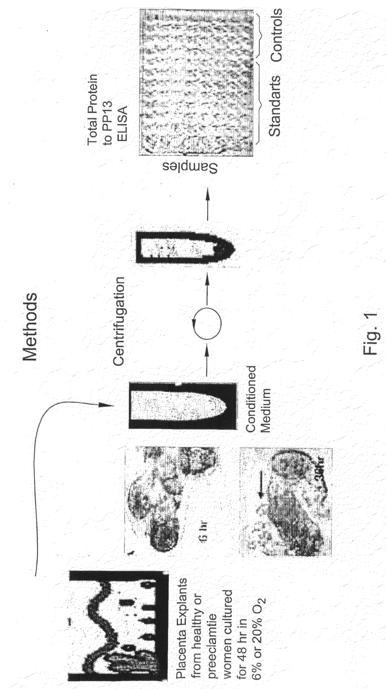 Method for Determining the Effectiveness of a Treatment for Preeclampsia