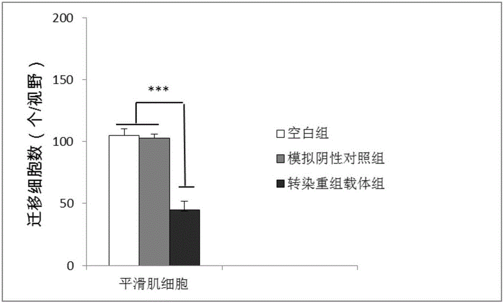 Adenovirus vector for specifically inhibiting proliferation and migration of smooth muscle cells and application of adenovirus vector