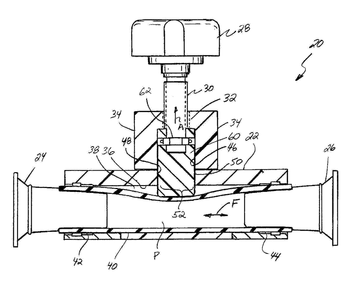 Pinch valve