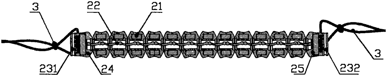 Implantable device for anti-gastroesophageal reflux