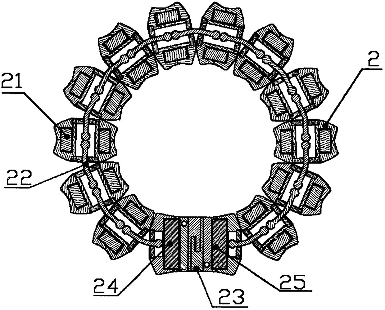 Implantable device for anti-gastroesophageal reflux