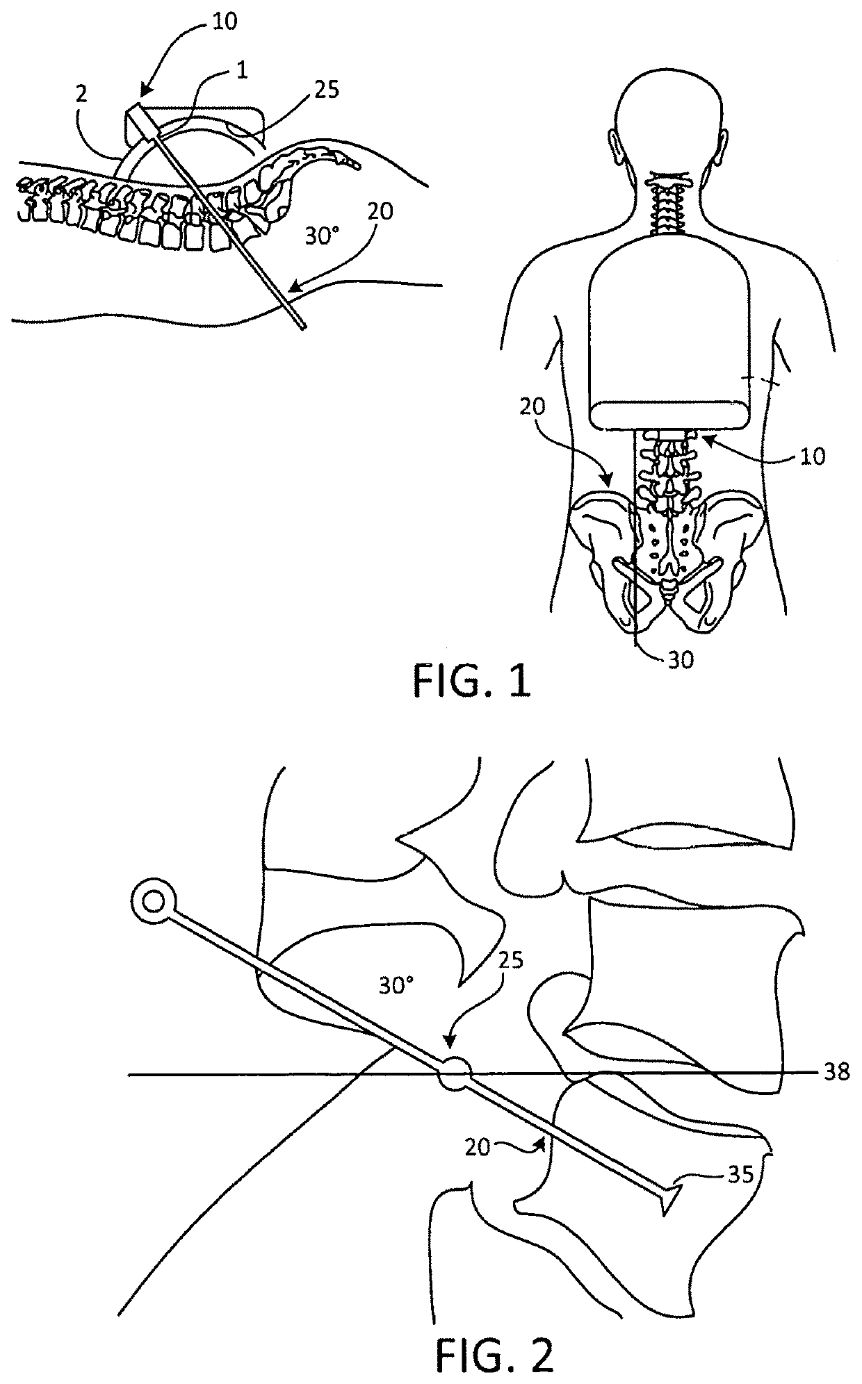 Surgical targeting systems and methods
