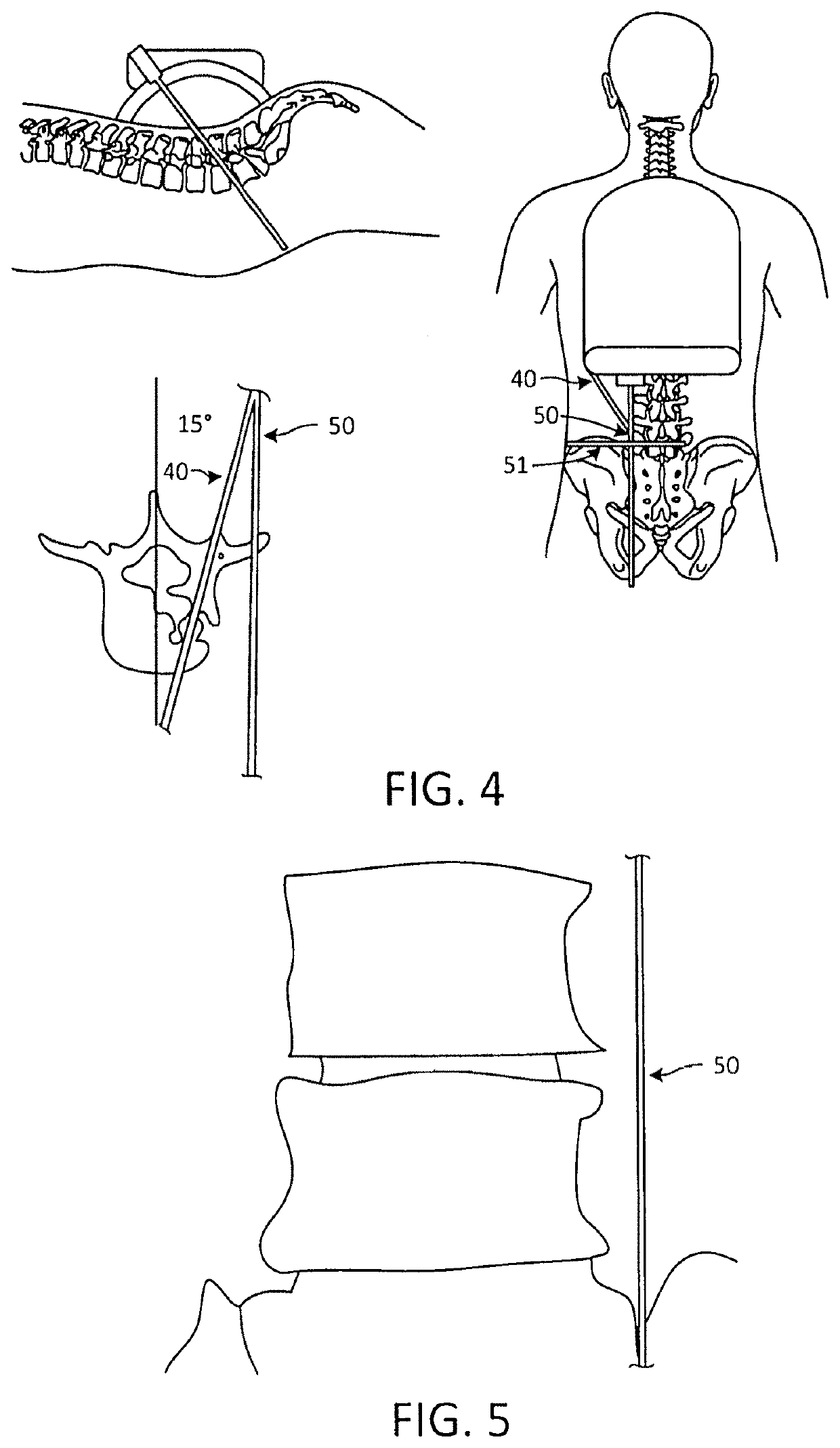 Surgical targeting systems and methods