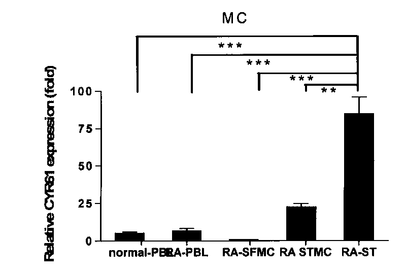 Monoclonal antibody (hybrid tumor) for neutralizing CYR61 and applications thereof