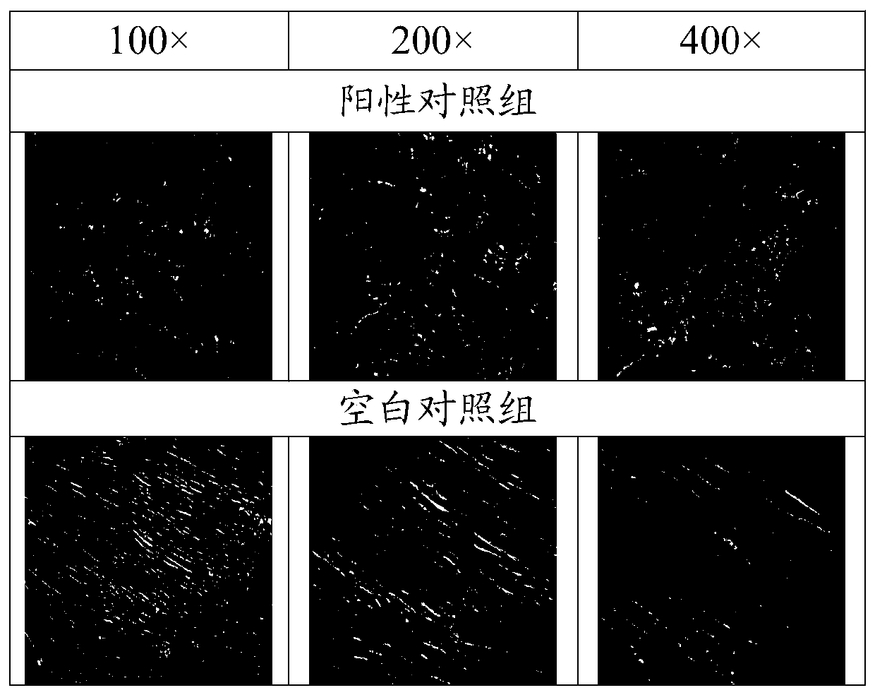 Culture medium, application thereof and method for inducing differentiation of tendon stem cells to adipocytes