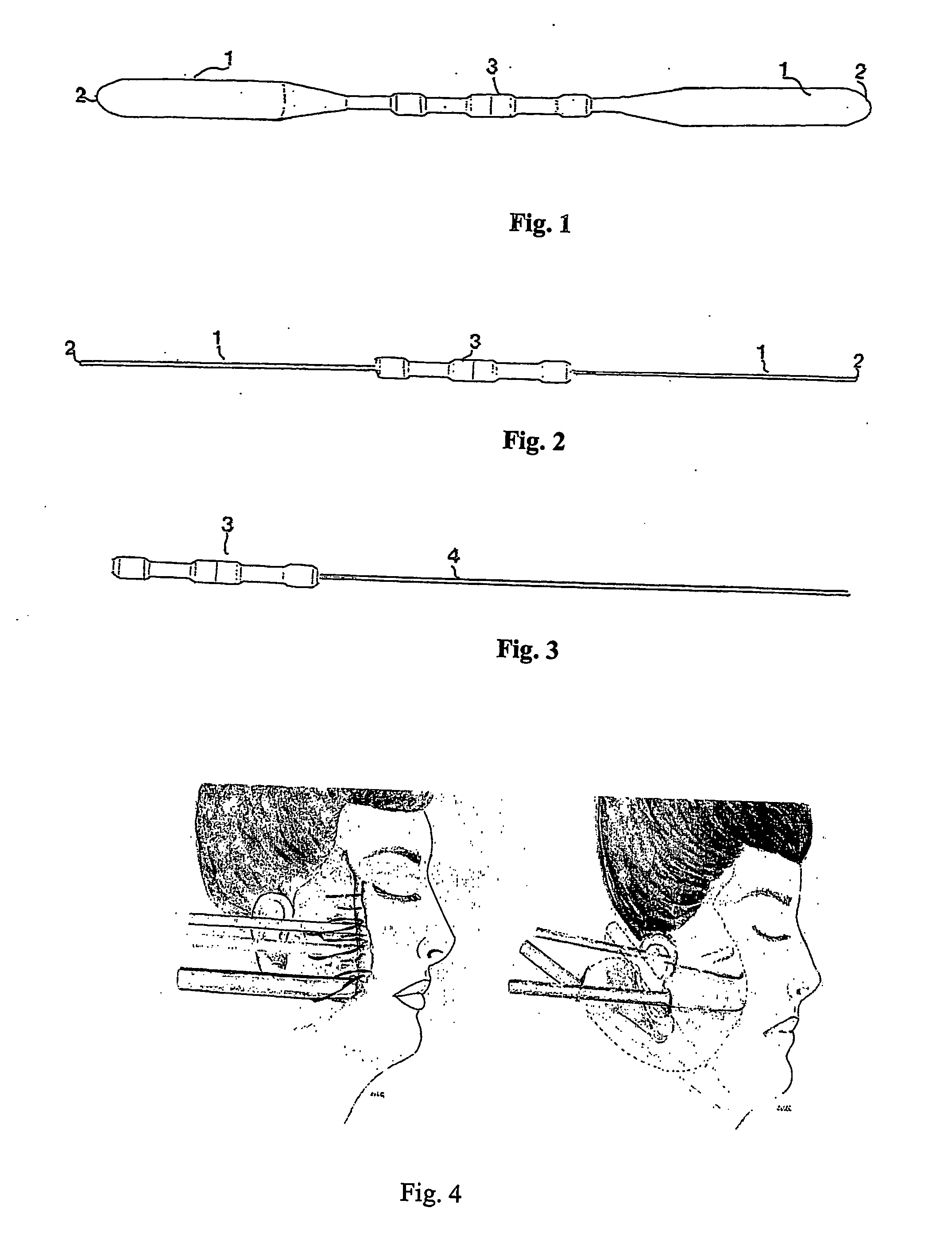 Surgical device and method for cutaneous detachment of skin
