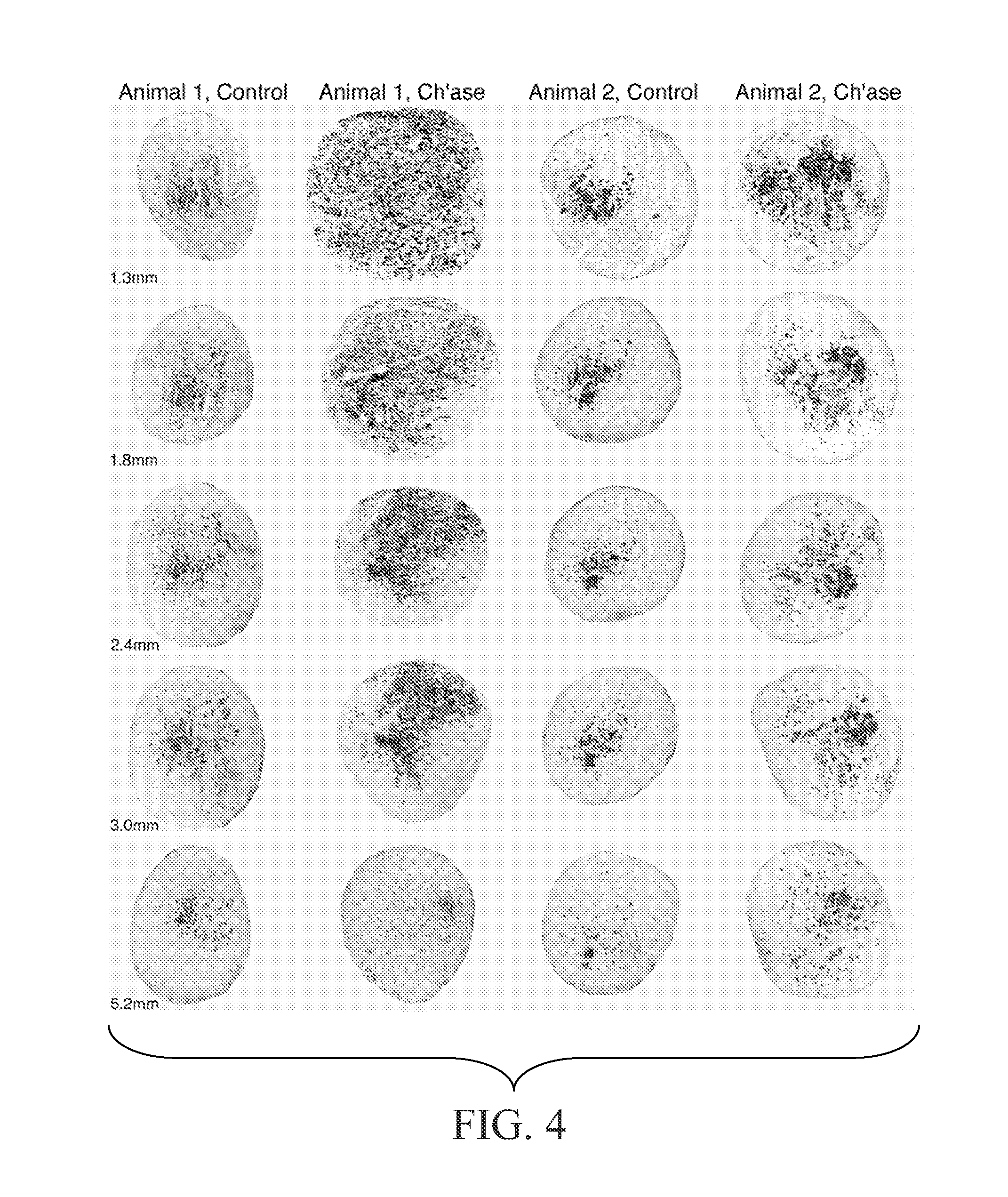 Material and Methods for Nerve Grafting