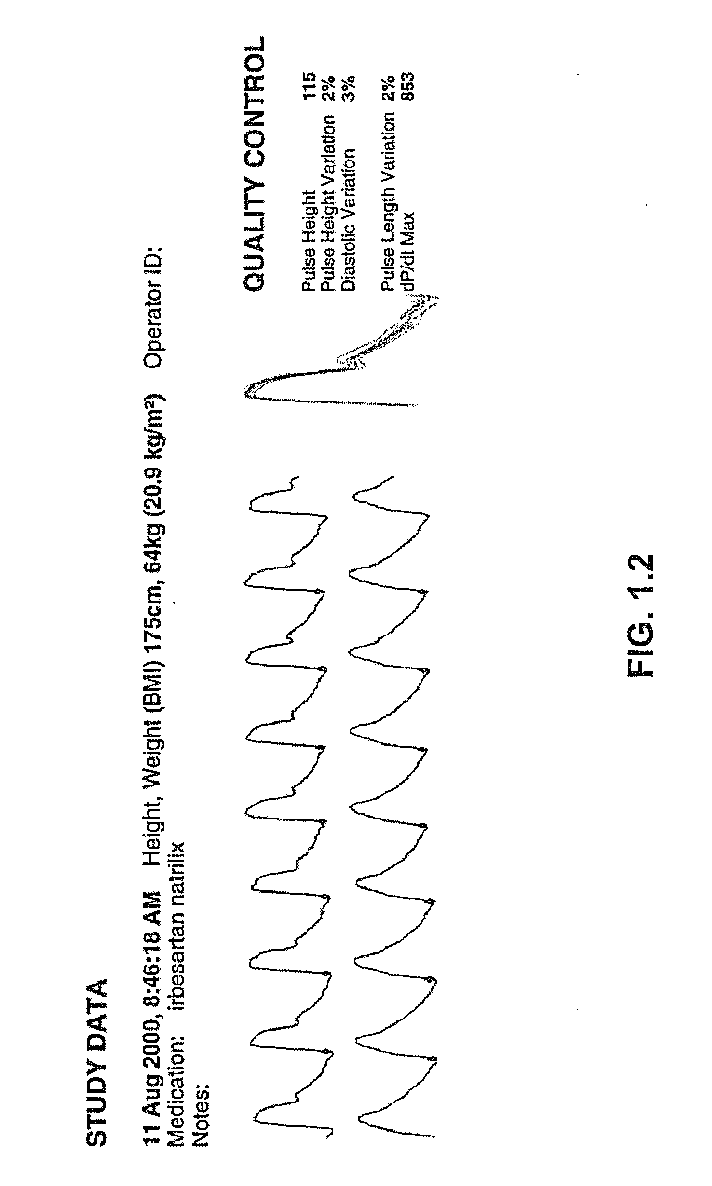 Cardiovascular pulse wave analysis method and system