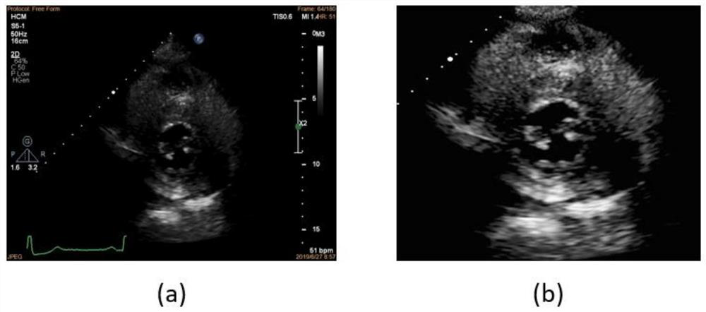 Ultrasonic image left ventricular myocardium segmentation method and system and application