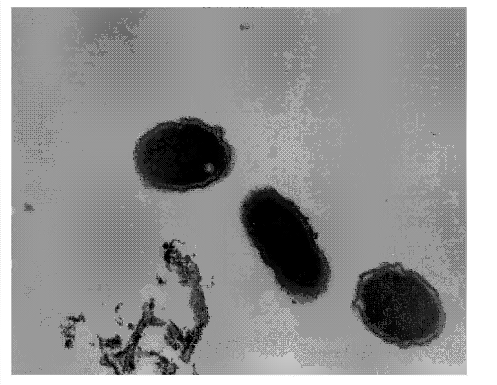 Application of Chinese medicine composition in preparation of medicament for treating overhigh level of urine cell factor or receptor thereof and Escherichia coli infection