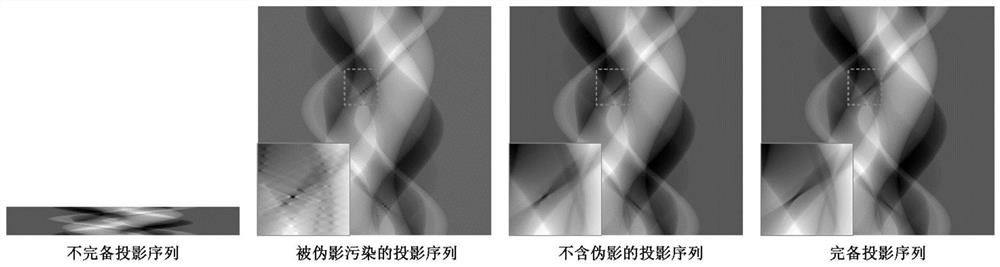 A Deep Learning-Based Method for Incomplete Data Reconstruction of X-ray Absorption Contrast Computed Tomography