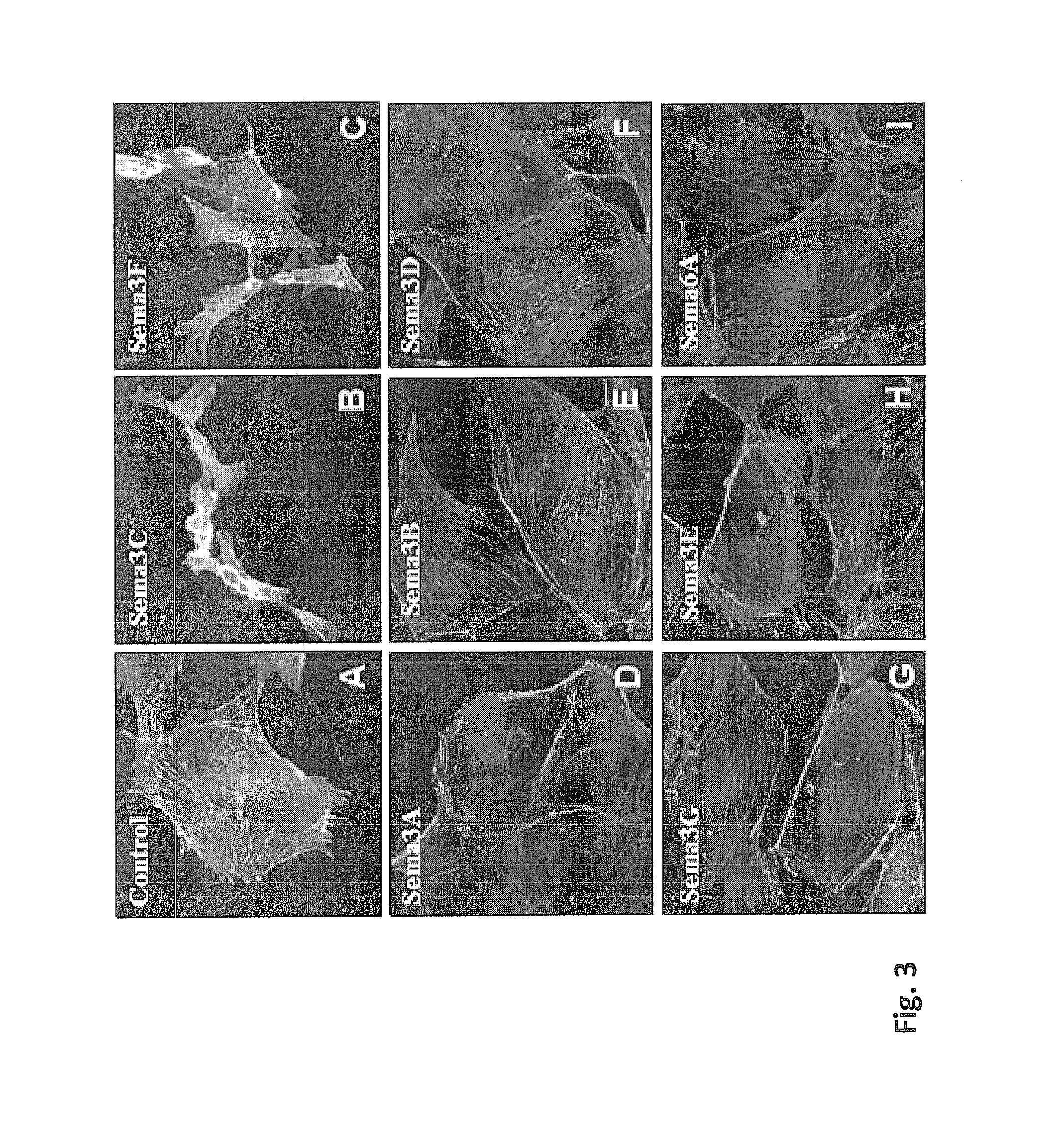 Semaphorin 3c variants, compositions comprising said variants and methods of use thereof