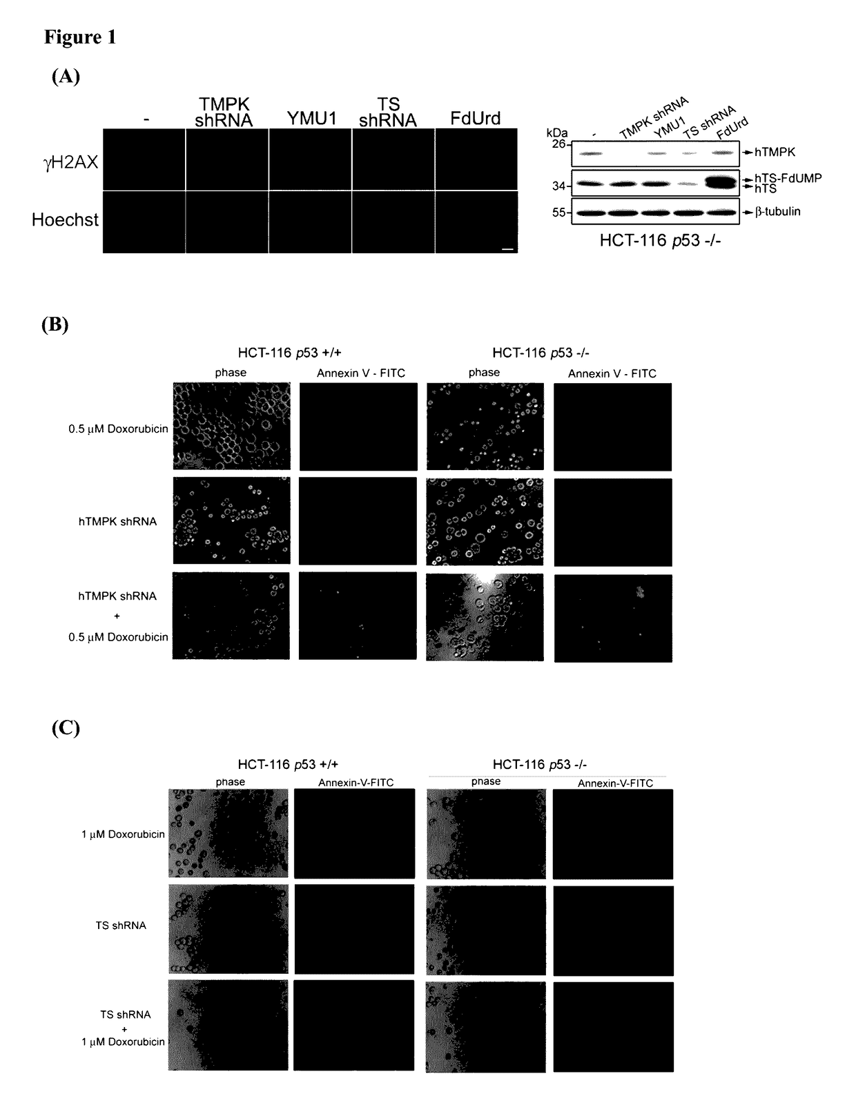 Targeting human thymidylate kinase induces DNA repair toxicity in malignant tumor cells