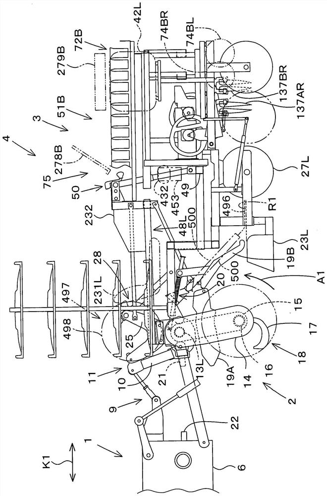 transplant operation machinery