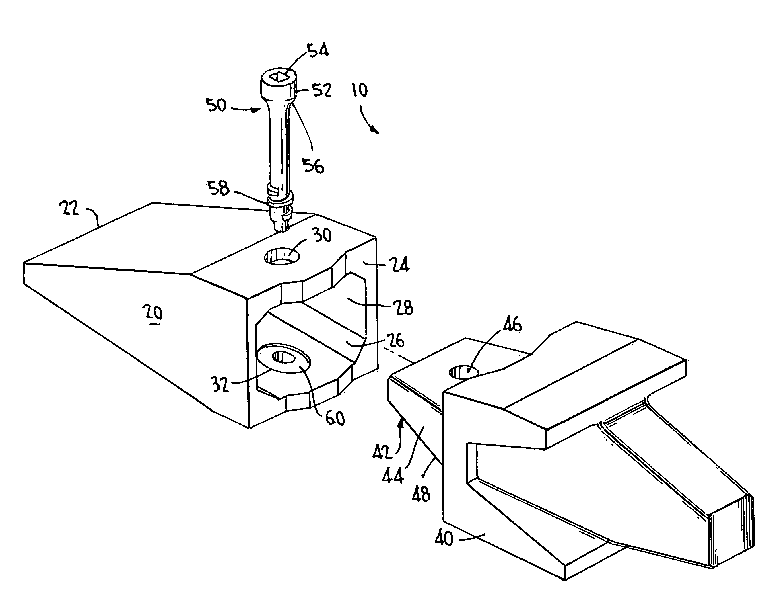 Excavation retention assembly