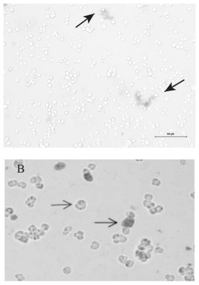 Duck embryo primary hepatocyte separation culture method