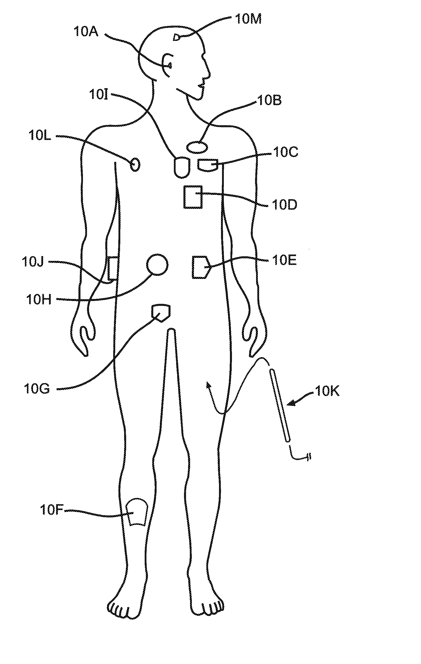 Positioning of a medical device conductor in an MRI environment to reduce RF induced current
