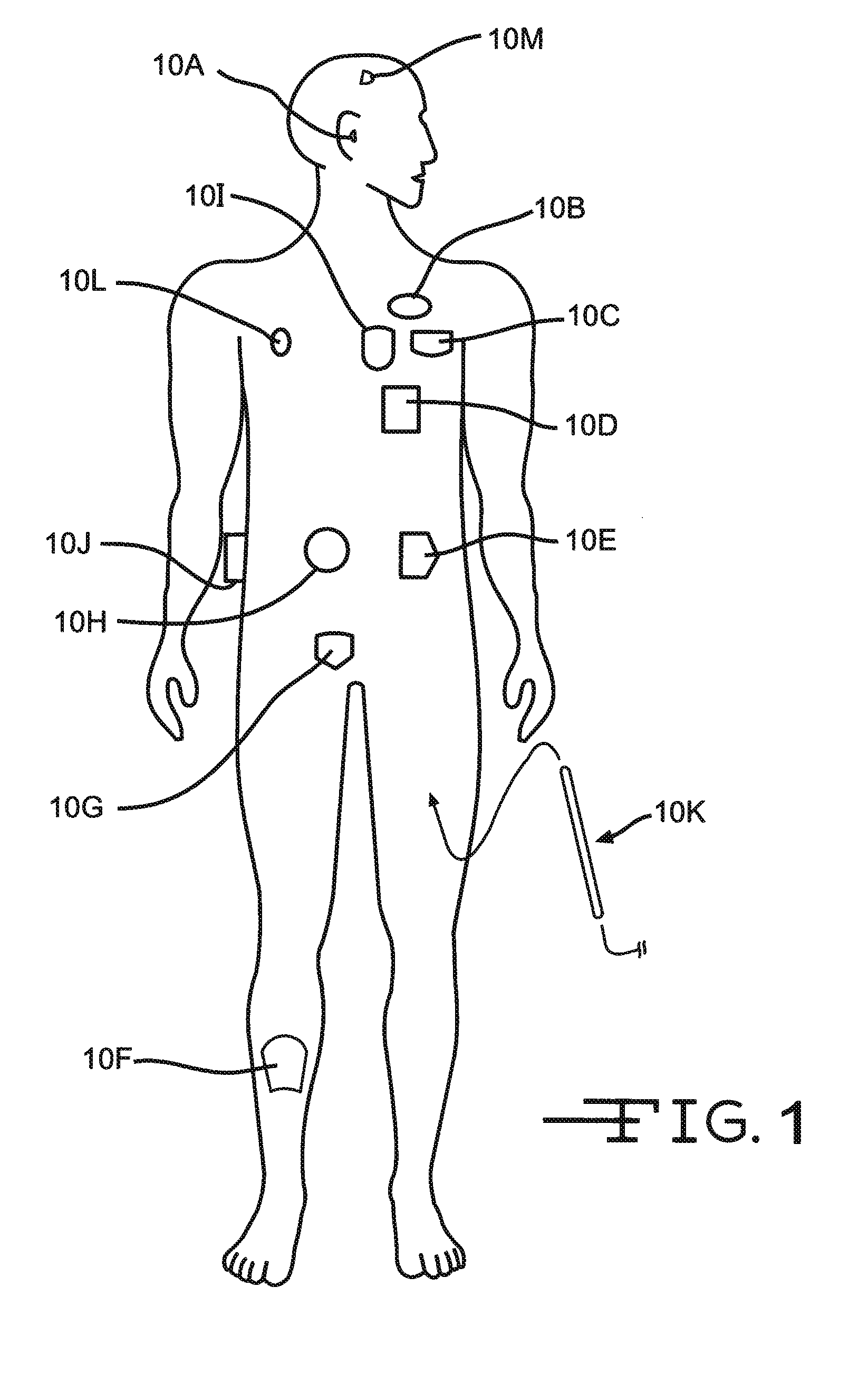 Positioning of a medical device conductor in an MRI environment to reduce RF induced current