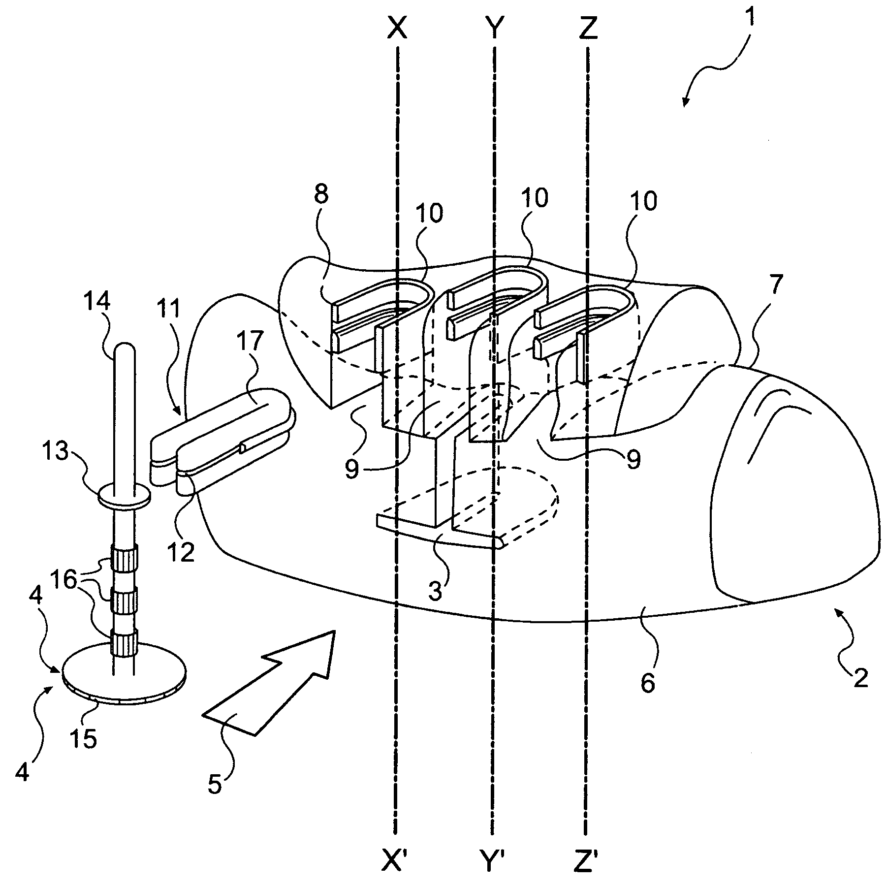 Custom-fit implant surgery guide and associated milling cutter, method for their production, and their use