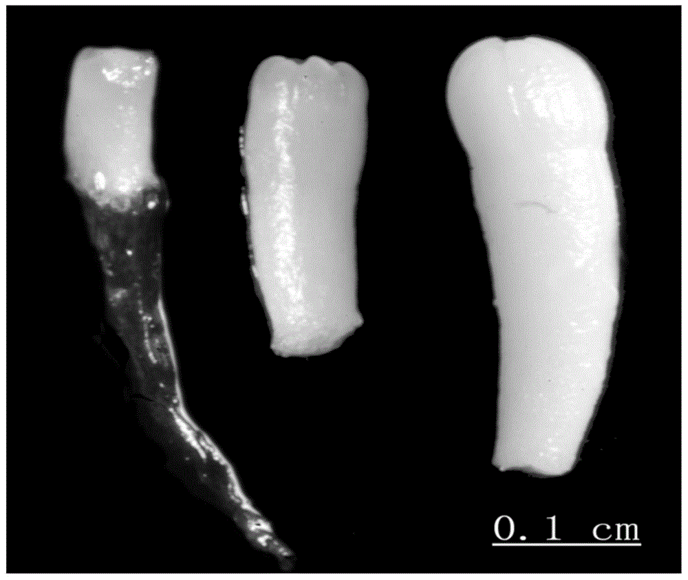 Somatic Embryogenesis and Plantlet Regeneration of Picea twigs