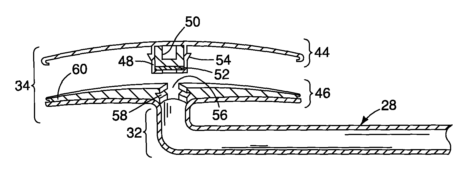 Method and apparatus for reducing intraocular pressure