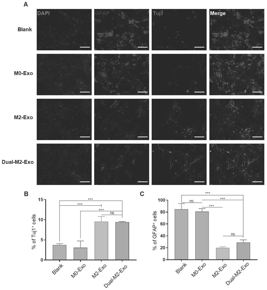 Bifunctional exosome, preparation method thereof and application in cerebral apoplexy repair