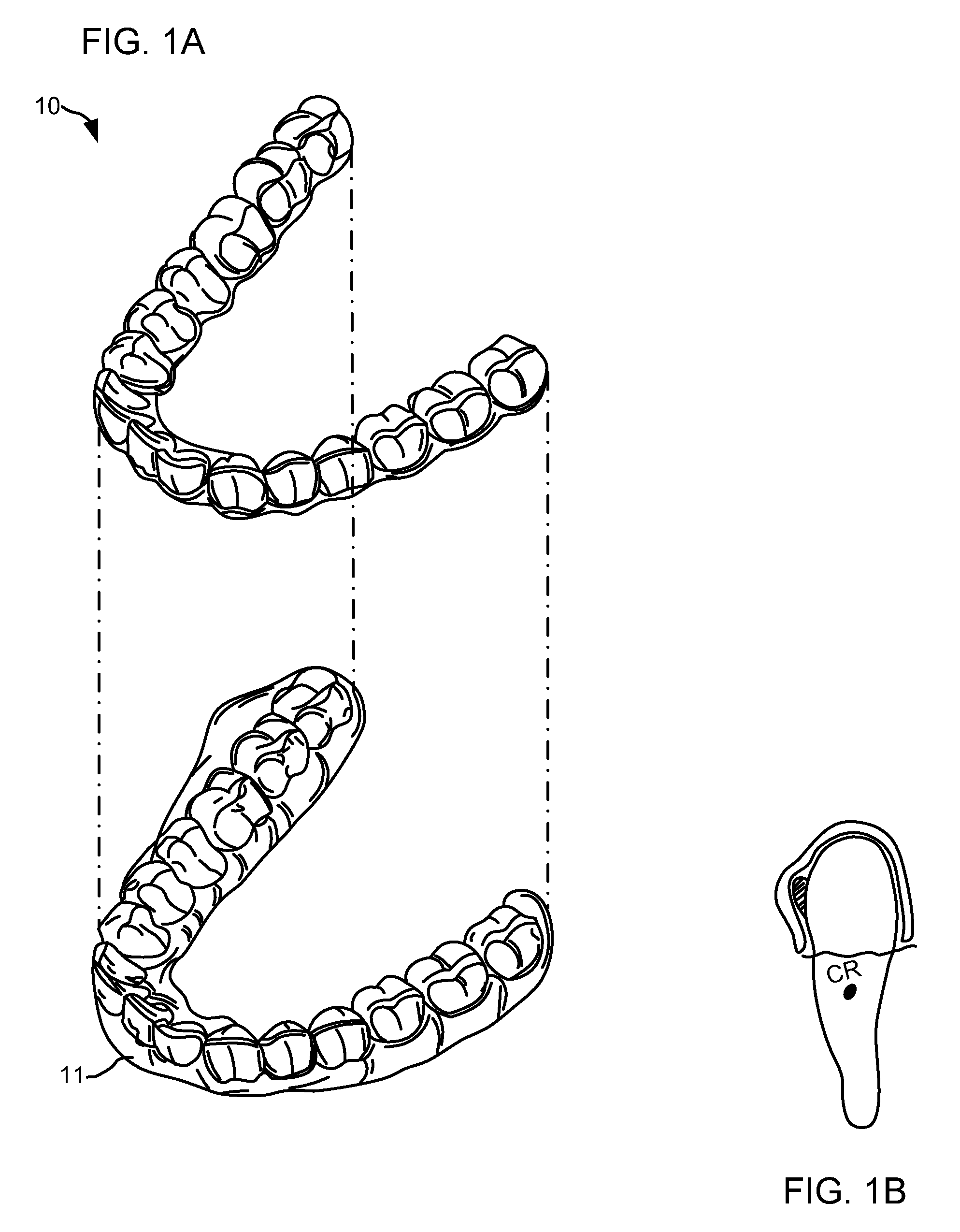 Orthodontic systems and methods including parametric attachments