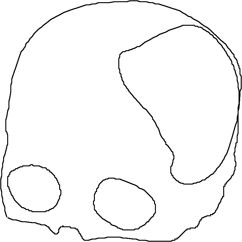 Preparation method of personalized skull dummy