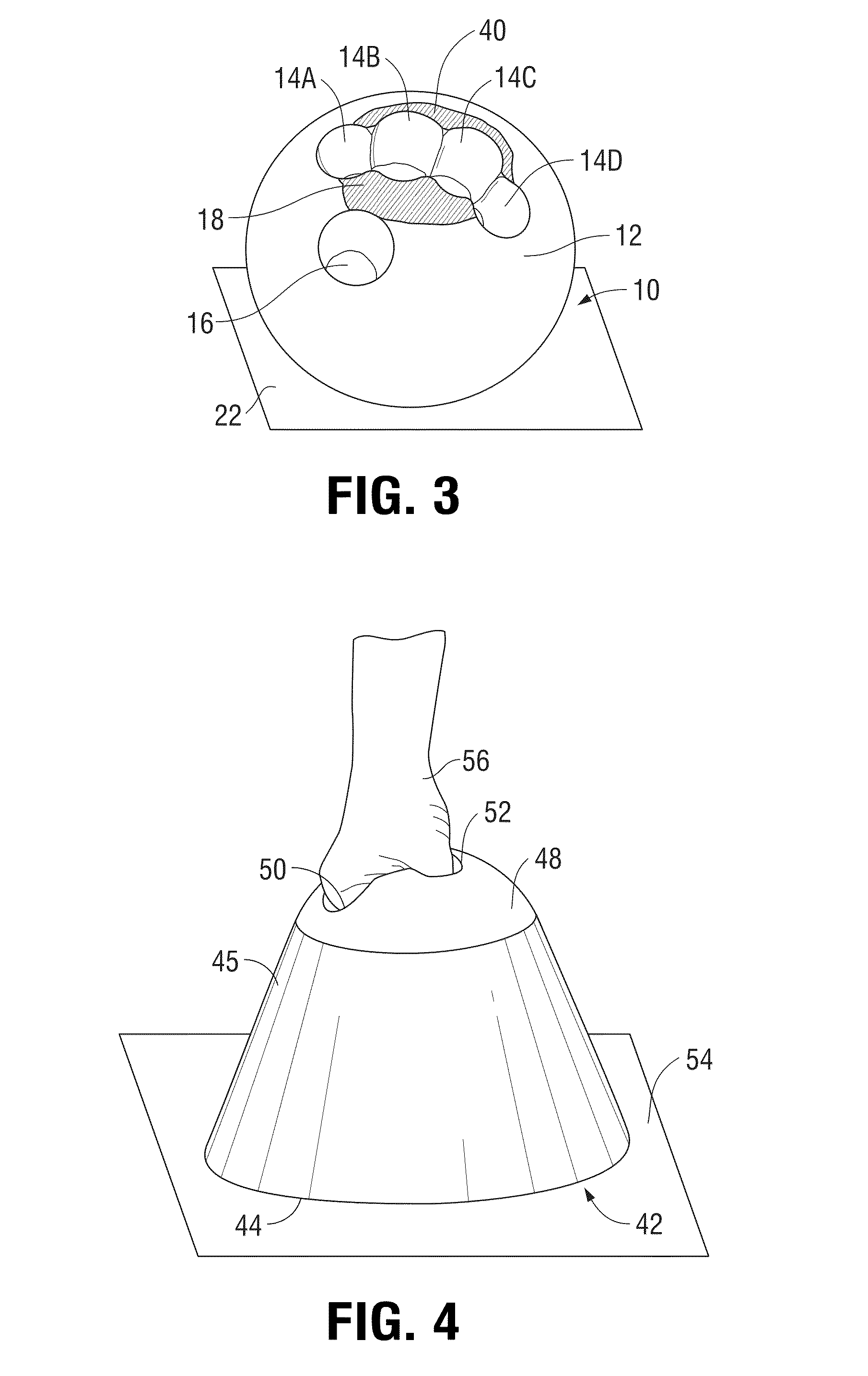 Wrist support device