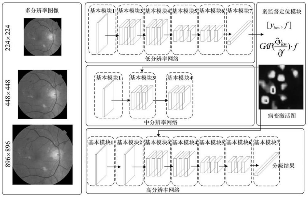 Retinopathy detection system based on lesion attention pyramid convolutional neural network