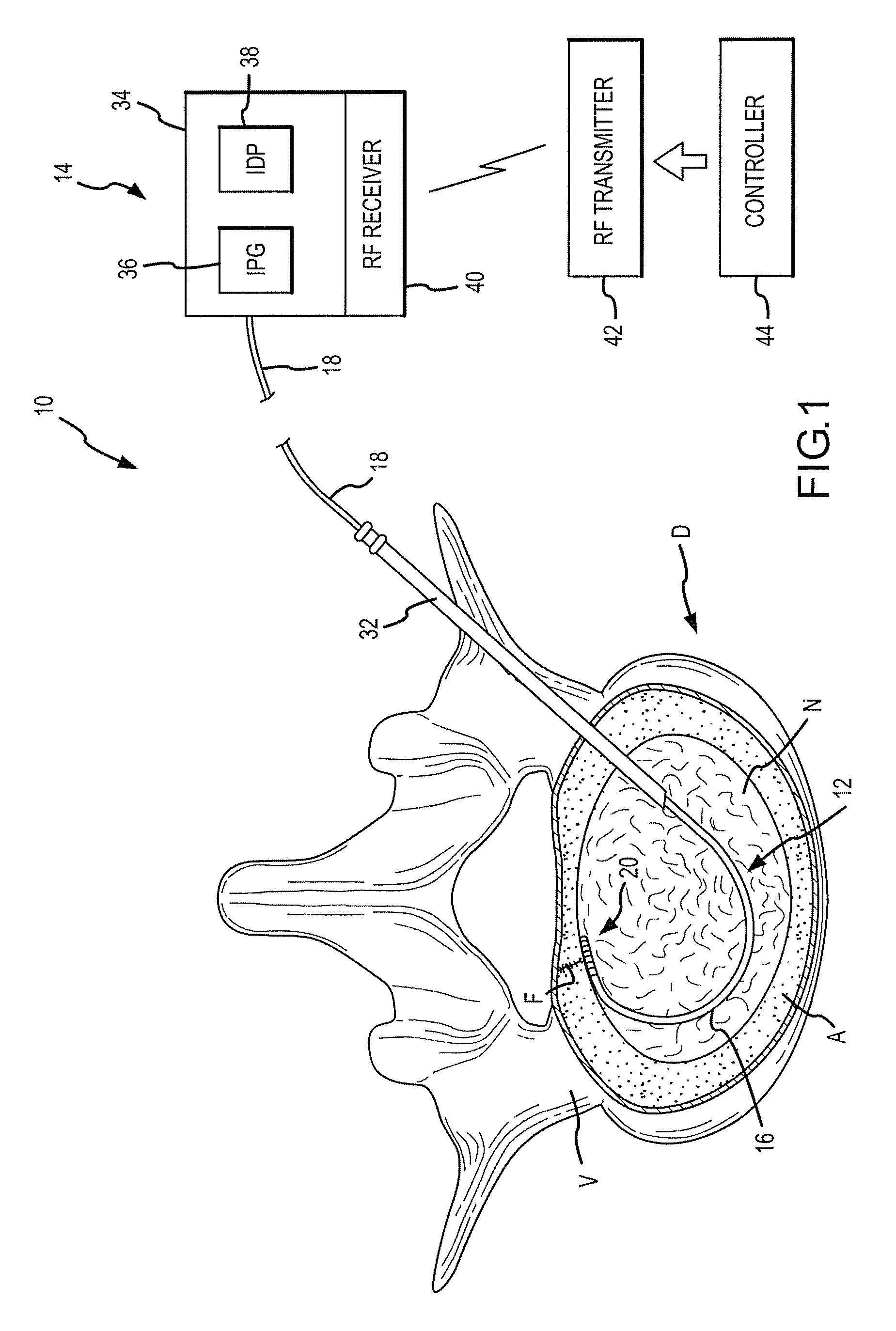 Combination Electrical Stimulating And Infusion Medical Device and Method