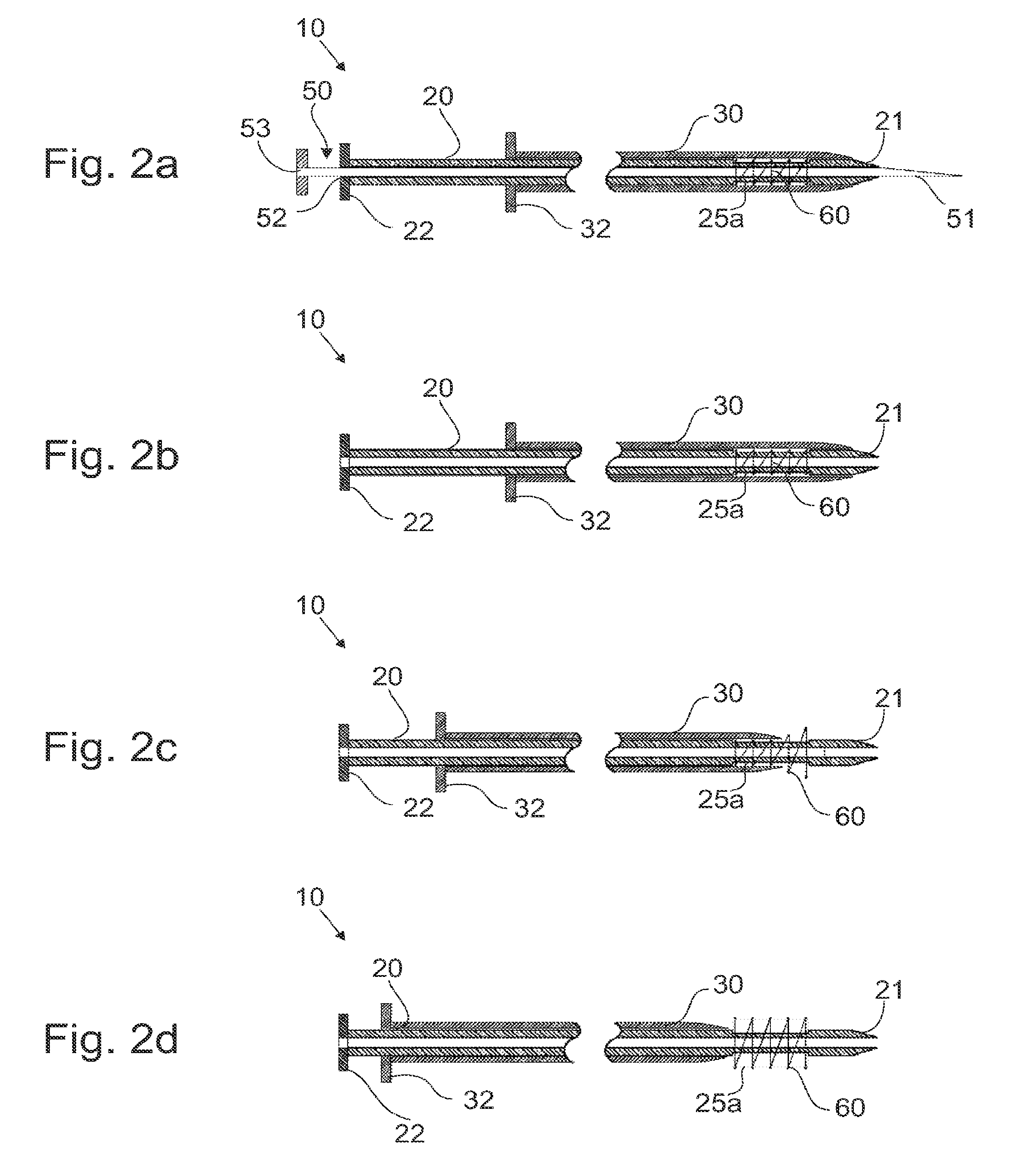 Devices, systems and methods for creation of a peripherally located fistula