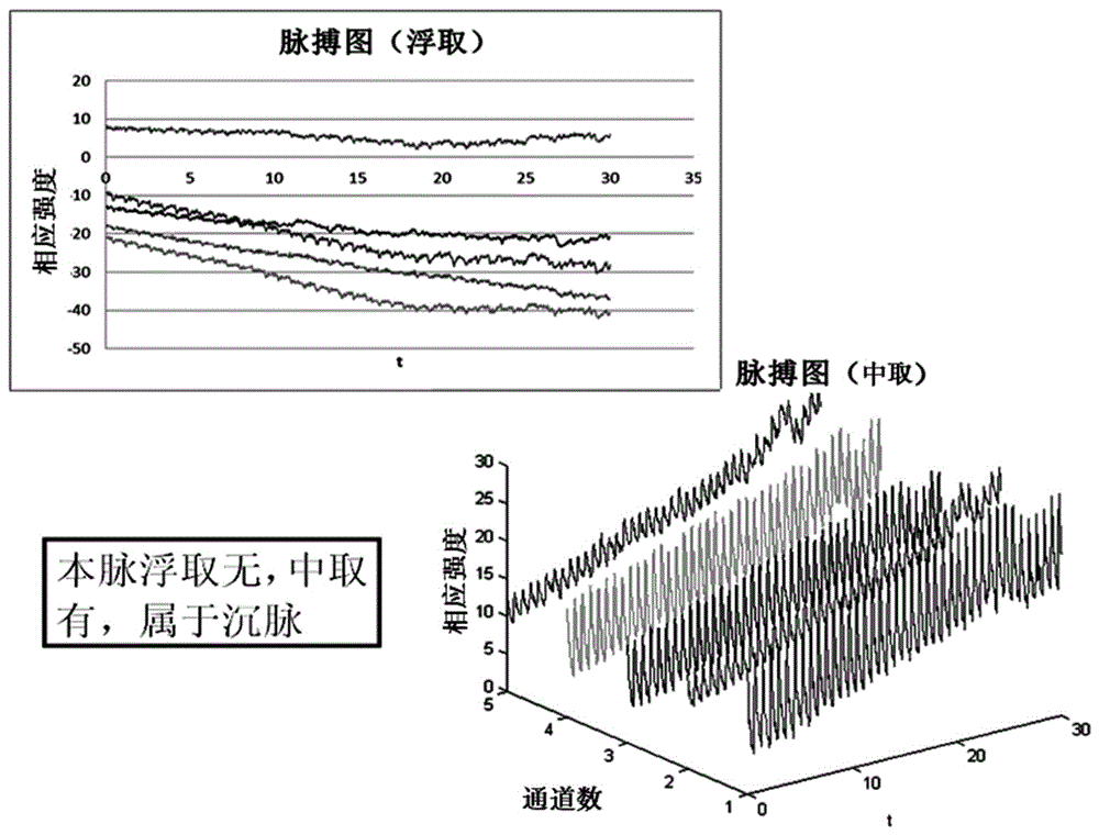 TCM diagnosis system