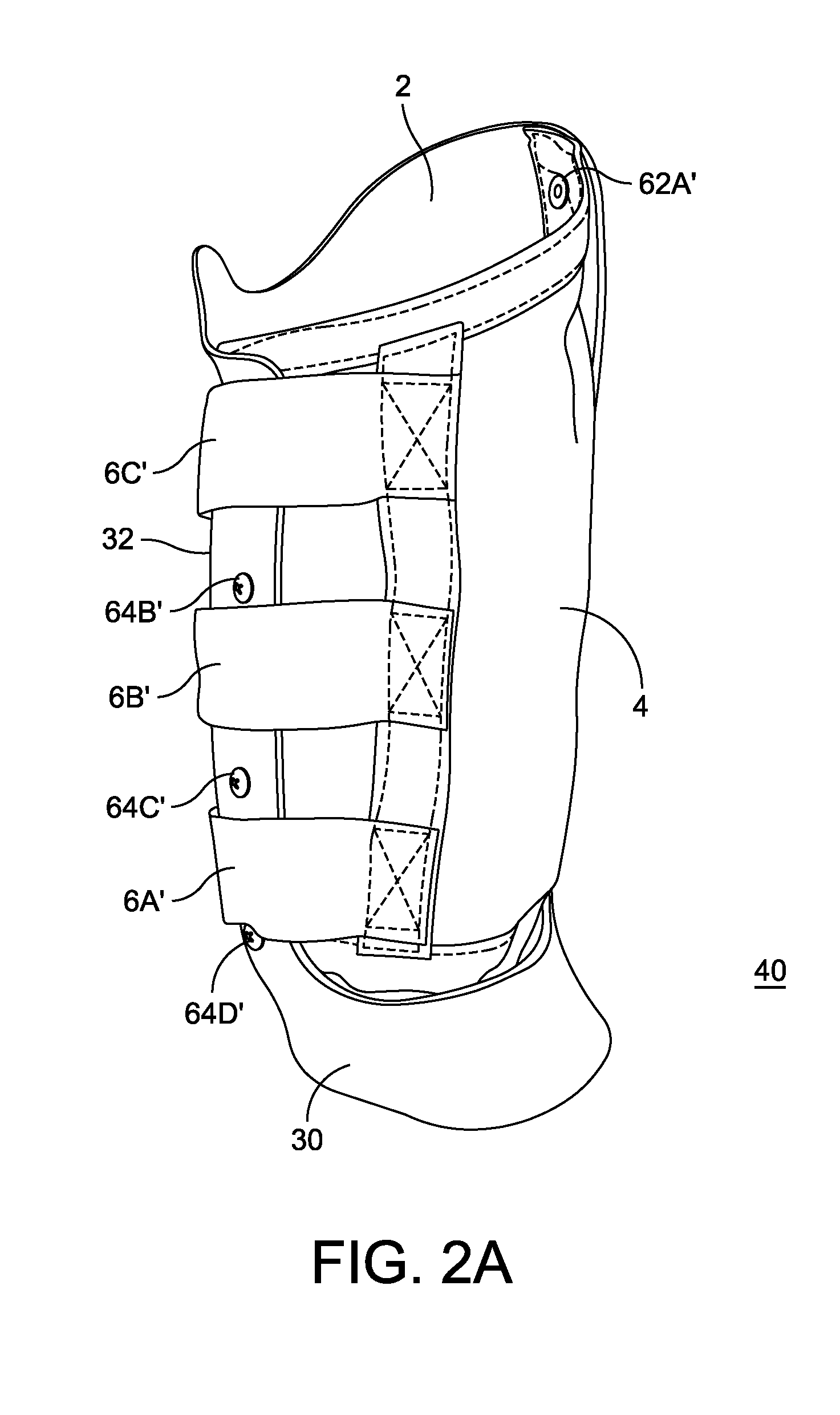 Adjustable prosthetic limb socket